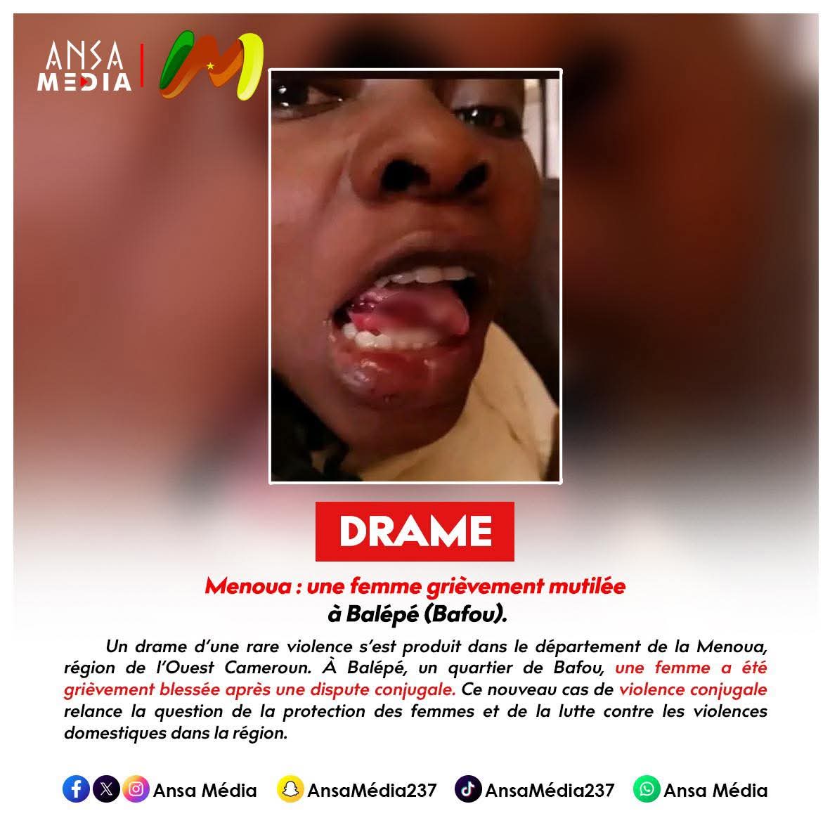 Menoua : une femme grièvement mutilée à Balépé (Bafou).