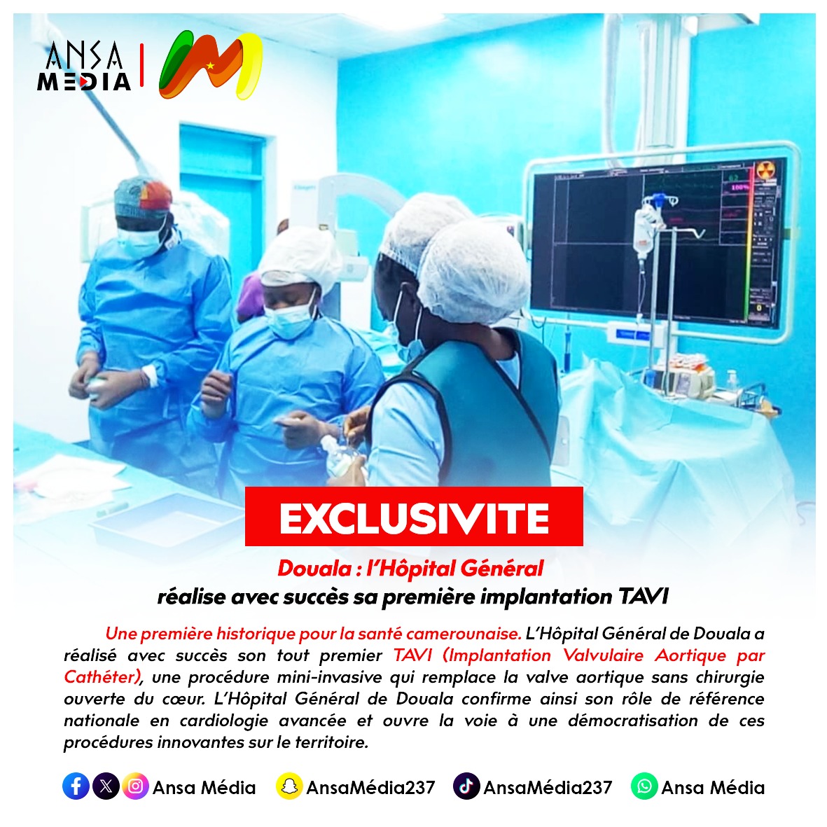 Douala : l’Hôpital Général réalise avec succès sa première implantation TAVI