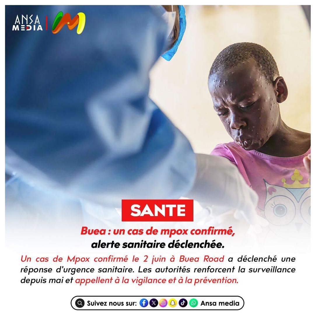 Buea : un cas de mpox confirmé, alerte sanitaire déclenchée.